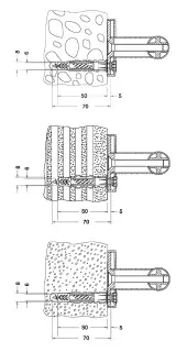 Keuco Plan Care Крепёжный комплект для поручня 34990 000100